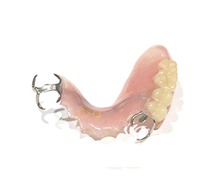 レジン床義歯 イメージ画像